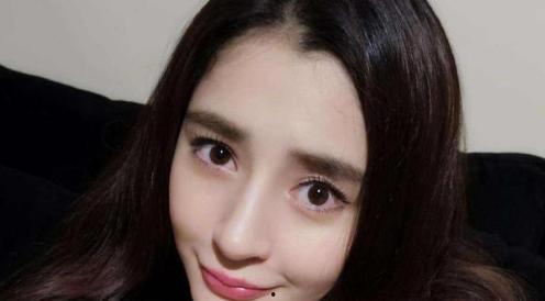 坏牙明星网红有哪些,牙齿问题成焦点