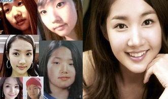 女明星网红能整容吗,美丽背后的秘密