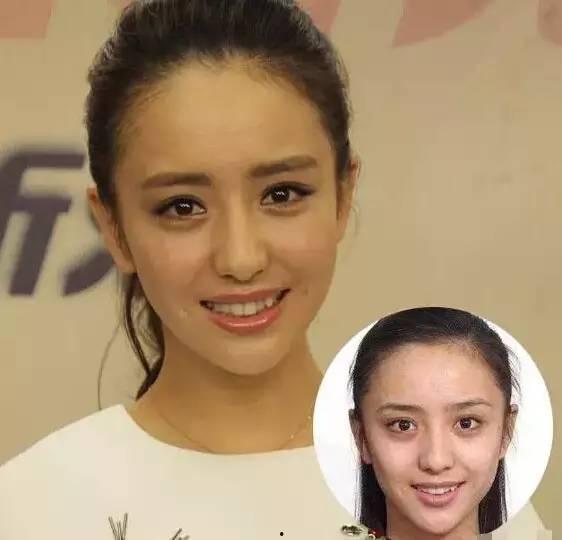牙贴面对比明星网红,效果对比，谁更胜一筹？