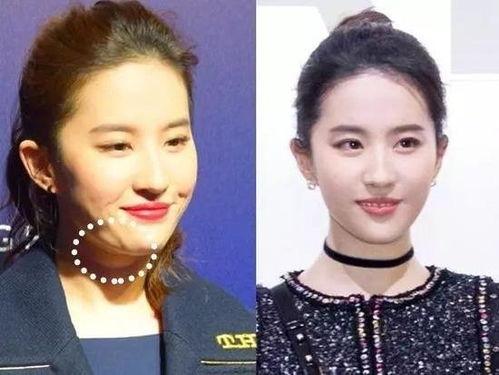 明星网红瘦脸视频素材,轻松打造V脸效果