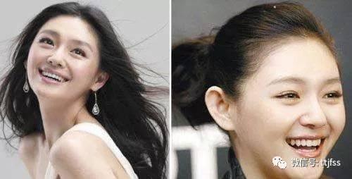 明星网红瘦脸视频素材,轻松打造V脸效果