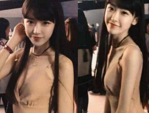 明星网红拔罐图片大全,揭秘明星们的健康秘籍