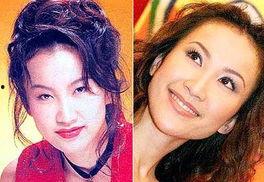 明星网红整形前照片图片,揭秘网红整形前后的惊人蜕变！