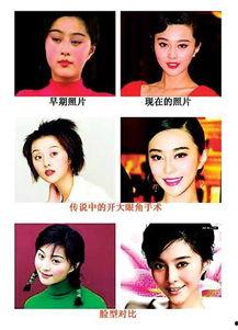 明星网红整形前照片图片,揭秘网红整形前后的惊人蜕变！