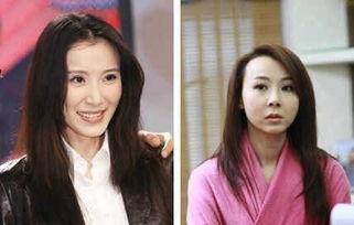 明星网红整形前照片图片,揭秘网红整形前后的惊人蜕变！